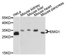 EMG1 / NEP1 Antibody - Western blot analysis of extracts of various cells.