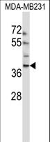 EMID1 Antibody - EMID1 Antibody western blot of MDA-MB231 cell line lysates (35 ug/lane). The EMID1 antibody detected the EMID1 protein (arrow).
