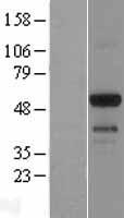 EMID1 Protein - Western validation with an anti-DDK antibody * L: Control HEK293 lysate R: Over-expression lysate