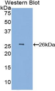 EMILIN1 / EMI Antibody - Western blot of recombinant EMILIN1 / EMI.  This image was taken for the unconjugated form of this product. Other forms have not been tested.