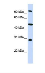 EML1 / EMAP Antibody - HepG2 cell lysate. Antibody concentration: 1.0 ug/ml. Gel concentration: 12%.  This image was taken for the unconjugated form of this product. Other forms have not been tested.