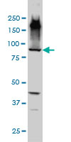 EML1 / EMAP Antibody - EML1 monoclonal antibody (M01A), clone 5G3 Western Blot analysis of EML1 expression in HepG2.