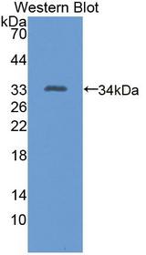 EML2 / EMAP2 Antibody - Western blot of EML2 / EMAP2 antibody.