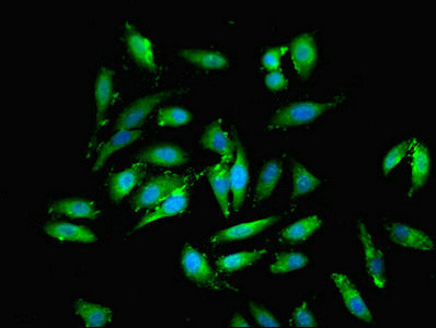 EML2 / EMAP2 Antibody - Immunofluorescent analysis of Hela cells using EML2 Antibody at dilution of 1:100 and Alexa Fluor 488-congugated AffiniPure Goat Anti-Rabbit IgG(H+L)
