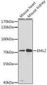 EML2 / EMAP2 Antibody - Western blot analysis of extracts of various cell lines using EML2 Polyclonal Antibody at dilution of 1:3000.