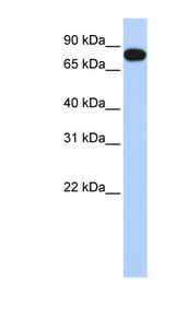 EML3 Antibody - EML3 antibody Western blot of Placenta lysate. This image was taken for the unconjugated form of this product. Other forms have not been tested.
