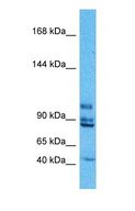EML4 Antibody - Western blot of EML4 Antibody with human PANC1 Whole Cell lysate.  This image was taken for the unconjugated form of this product. Other forms have not been tested.