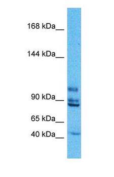 EML4 Antibody - Western blot of EML4 Antibody with human PANC1 Whole Cell lysate.  This image was taken for the unconjugated form of this product. Other forms have not been tested.