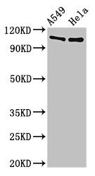 EML4 Antibody - Positive Western Blot detected in A549 whole cell lysate, Hela whole cell lysate. All lanes: EML4 antibody at 3 µg/ml Secondary Goat polyclonal to rabbit IgG at 1/50000 dilution. Predicted band size: 109, 103 KDa. Observed band size: 109 KDa