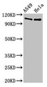 EML4 Antibody - Positive Western Blot detected in A549 whole cell lysate, Hela whole cell lysate. All lanes: EML4 antibody at 3 µg/ml Secondary Goat polyclonal to rabbit IgG at 1/50000 dilution. Predicted band size: 109, 103 KDa. Observed band size: 109 KDa