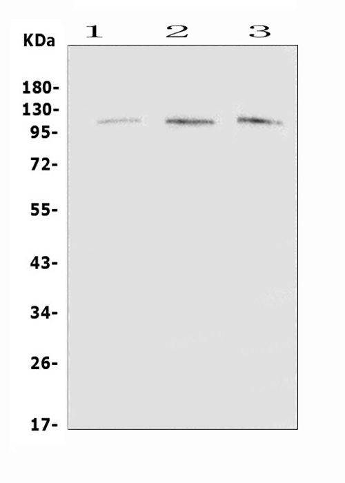 EML4 Antibody - Western blot analysis of EML4 using anti-EML4 antibody. Electrophoresis was performed on a 5-20% SDS-PAGE gel at 70V (Stacking gel) / 90V (Resolving gel) for 2-3 hours. The sample well of each lane was loaded with 50ug of sample under reducing conditions. Lane 1: rat brain tissue lysates,Lane 2: mouse brain tissue lysates,Lane 3: mouse lung tissue lysates. After Electrophoresis, proteins were transferred to a Nitrocellulose membrane at 150mA for 50-90 minutes. Blocked the membrane with 5% Non-fat Milk/ TBS for 1.5 hour at RT. The membrane was incubated with rabbit anti-EML4 antigen affinity purified polyclonal antibody at 0.5 µg/mL overnight at 4°C, then washed with TBS-0.1% Tween 3 times with 5 minutes each and probed with a goat anti-rabbit IgG-HRP secondary antibody at a dilution of 1:10000 for 1.5 hour at RT. The signal is developed using an Enhanced Chemiluminescent detection (ECL) kit with Tanon 5200 system. A specific band was detected for EML4 at approximately 120KD. The expected band size for EML4 is at 109KD.