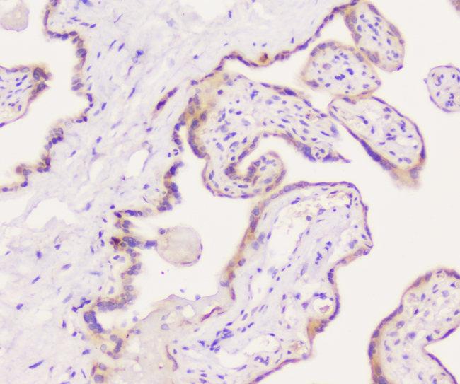 EML4 Antibody - IHC analysis of EML4 using anti-EML4 antibody. EML4 was detected in paraffin-embedded section of human placenta tissue. Heat mediated antigen retrieval was performed in citrate buffer (pH6, epitope retrieval solution) for 20 mins. The tissue section was blocked with 10% goat serum. The tissue section was then incubated with 1µg/ml rabbit anti-EML4 Antibody overnight at 4°C. Biotinylated goat anti-rabbit IgG was used as secondary antibody and incubated for 30 minutes at 37°C. The tissue section was developed using Strepavidin-Biotin-Complex (SABC) with DAB as the chromogen.