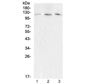 EML4 Antibody - Western blot testing of 1) rat brain, 2) mouse brain, 3) mouse lung lysate with EML4 antibody at 0.5ug/ml. Expected molecular weight: 108-120 kDa.