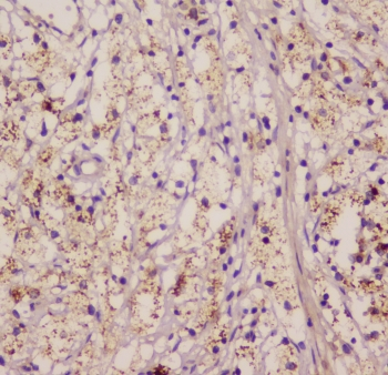EML4 Antibody - IHC staining of FFPE human appendicitis with EML4 antibody at 1ug/ml. HIER: boil tissue sections in pH6, 10mM citrate buffer, for 10-20 min followed by cooling at RT for 20 min.