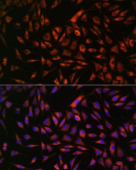 EML4 Antibody - Immunofluorescence analysis of L929 cells using EML4 Polyclonal Antibody at dilution of 1:100.Blue: DAPI for nuclear staining.