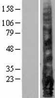 EMP1 Protein - Western validation with an anti-DDK antibody * L: Control HEK293 lysate R: Over-expression lysate