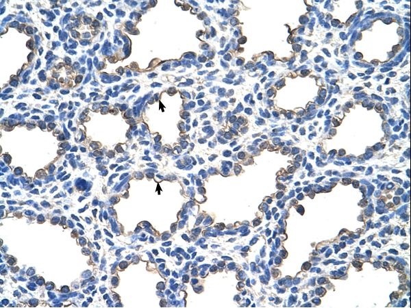 EMP2 Antibody - EMP2 antibody ARP41470_T100-NP_001415-EMP2(epithelial membrane protein 2) Antibody was used in IHC to stain formalin-fixed, paraffin-embedded human lung.  This image was taken for the unconjugated form of this product. Other forms have not been tested.