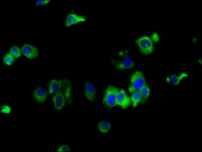 EMP2 Antibody - Immunofluorescence staining of MCF-7 cells diluted at 1:133, counter-stained with DAPI. The cells were fixed in 4% formaldehyde, permeabilized using 0.2% Triton X-100 and blocked in 10% normal Goat Serum. The cells were then incubated with the antibody overnight at 4°C.The Secondary antibody was Alexa Fluor 488-congugated AffiniPure Goat Anti-Rabbit IgG (H+L).