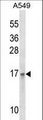 EMP3 Antibody - EMP3 Antibody western blot of A549 cell line lysates (35 ug/lane). The EMP3 antibody detected the EMP3 protein (arrow).