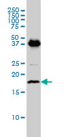 EMP3 Antibody - EMP3 monoclonal antibody (M01), clone 3D4 Western blot of EMP3 expression in C32.