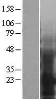 EMP3 Protein - Western validation with an anti-DDK antibody * L: Control HEK293 lysate R: Over-expression lysate