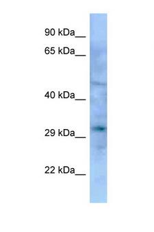 EMX1 Antibody - EMX1 antibody Western blot of Mouse Pancreas lysate. Antibody concentration 1 ug/ml.  This image was taken for the unconjugated form of this product. Other forms have not been tested.