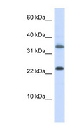 EMX1 Antibody - EMX1 antibody Western blot of HepG2 cell lysate. This image was taken for the unconjugated form of this product. Other forms have not been tested.