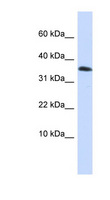EMX1 Antibody - EMX1 antibody Western blot of HepG2 cell lysate. This image was taken for the unconjugated form of this product. Other forms have not been tested.