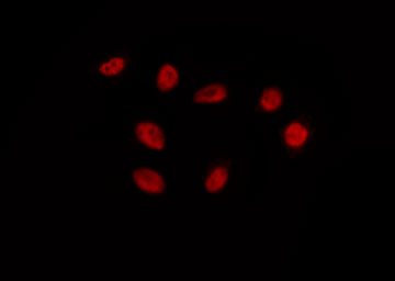 EMX1 Antibody - Staining HepG2 cells by IF/ICC. The samples were fixed with PFA and permeabilized in 0.1% Triton X-100, then blocked in 10% serum for 45 min at 25°C. The primary antibody was diluted at 1:200 and incubated with the sample for 1 hour at 37°C. An Alexa Fluor 594 conjugated goat anti-rabbit IgG (H+L) Ab, diluted at 1/600, was used as the secondary antibody.