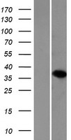 EMX1 Protein - Western validation with an anti-DDK antibody * L: Control HEK293 lysate R: Over-expression lysate