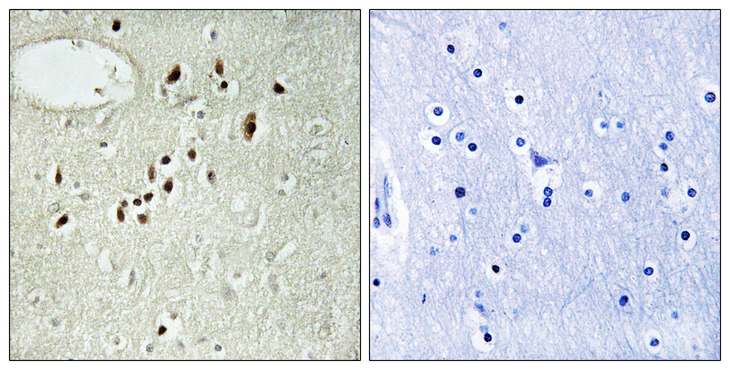 EMX2 Antibody - Immunohistochemistry analysis of paraffin-embedded human brain tissue, using EMX2 Antibody. The picture on the right is blocked with the synthesized peptide.