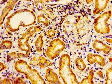 EMX2 Antibody - Immunohistochemistry image of paraffin-embedded human kidney tissue at a dilution of 1:100