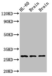 EMX2 Antibody - Positive Western Blot detected in Rat brain tissue, Mouse brain tissue. All lanes: EMX2 antibody at 2.7 µg/ml Secondary Goat polyclonal to rabbit IgG at 1/50000 dilution. Predicted band size: 29, 19 KDa. Observed band size: 29 KDa