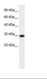 EMX2 Antibody - HepG2 Cell Lysate.  This image was taken for the unconjugated form of this product. Other forms have not been tested.