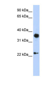 EN1 / Engrailed Antibody - EN1 antibody Western blot of HepG2 cell lysate. This image was taken for the unconjugated form of this product. Other forms have not been tested.