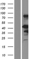 EN1 / Engrailed Protein - Western validation with an anti-DDK antibody * L: Control HEK293 lysate R: Over-expression lysate