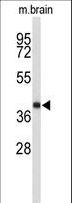 EN2 Antibody - Western blot of EN2 antibody in 293 cell line lysates and mouse stomach and lung tissue lysates (35 ug/lane). EN2 (arrow) was detected using the purified antibody.