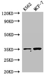 EN2 Antibody - Positive WB detected in:K562 whole cell lysate,MCF-7 whole cell lysate;All lanes:EN2 antibody at 2.8?g/ml;Secondary;Goat polyclonal to rabbit IgG at 1/50000 dilution;Predicted band size: 35 KDa;Observed band size: 35 KDa;