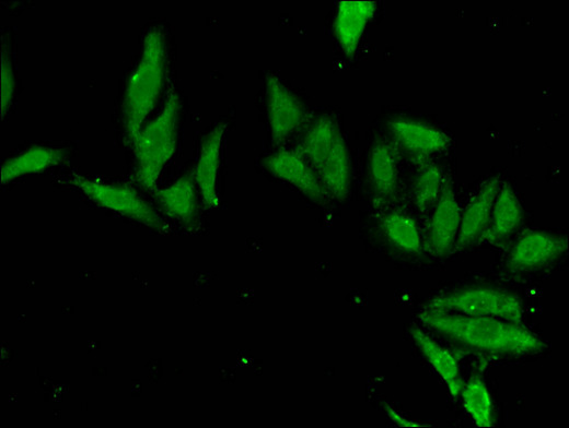 EN2 Antibody - Immunofluorescent analysis of Hela cells using EN2 Antibody at a dilution of 1:100 and Alexa Fluor 488-congugated AffiniPure Goat Anti-Rabbit IgG(H+L)
