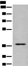EN2 Antibody - Western blot analysis of Jurkat cell lysate  using EN2 Polyclonal Antibody at dilution of 1:400