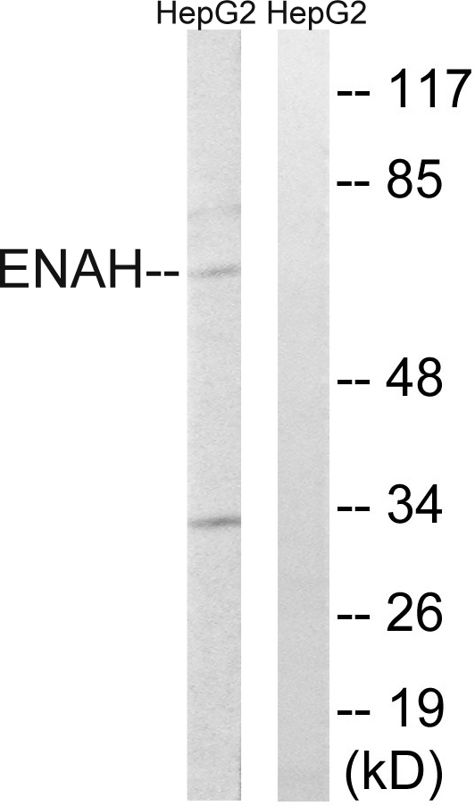 ENAH / MENA Antibody - Western blot analysis of lysates from HepG2 cells, using ENAH Antibody. The lane on the right is blocked with the synthesized peptide.