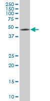 ENC1 Antibody - ENC1 monoclonal antibody (M03), clone 3C10. Western blot of ENC1 expression in IMR-32.