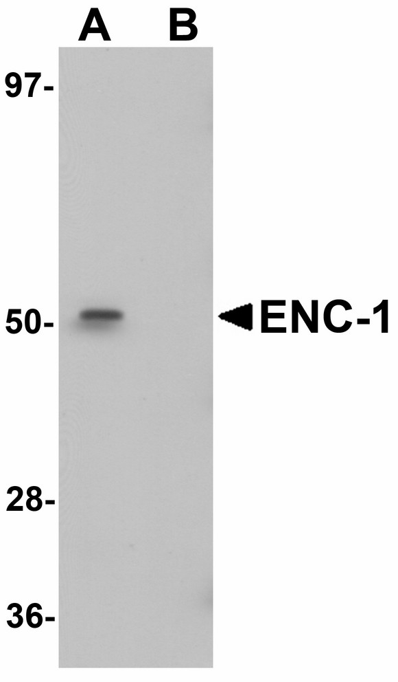 ENC1 Antibody - Western blot of ENC-1 in mouse kidney muscle tissue lysate with ENC-1 antibody at 1 ug/ml in (A) the absence and (B) the presence of blocking peptide.