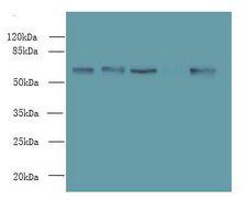 ENC1 Antibody - Western blot. All lanes: ENC1 antibody at 5 ug/ml. Lane 1: MCF7 whole cell lysate. Lane 2: HepG-2 whole cell lysate. Lane 3: Mouse brain tissue. Lane 4: A549 whole cell lysate. Secondary antibody: Goat polyclonal to Rabbit IgG at 1:10000 dilution. Predicted band size: 66 kDa. Observed band size: 66 kDa.