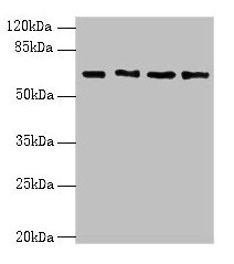 ENC1 Antibody - Western blot All lanes: ENC1 antibody at 5µg/ml Lane 1: MCF-7 whole cell lysate Lane 2: HepG2 whole cell lysate Lane 3: Mouse brain tissue Lane 4: A549 whole cell lysate Secondary Goat polyclonal to rabbit IgG at 1/10000 dilution Predicted band size: 67, 58 kDa Observed band size: 67 kDa