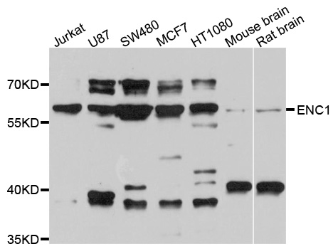 ENC1 Antibody - Western blot analysis of extracts of various cell lines, using ENC1 antibody at 1:1000 dilution. The secondary antibody used was an HRP Goat Anti-Rabbit IgG (H+L) at 1:10000 dilution. Lysates were loaded 25ug per lane and 3% nonfat dry milk in TBST was used for blocking. An ECL Kit was used for detection and the exposure time was 40s.