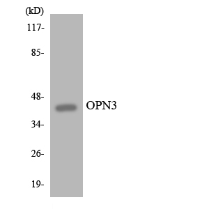 Encephalopsin / OPN3 Antibody - Western blot analysis of the lysates from Jurkat cells using OPN3 antibody.