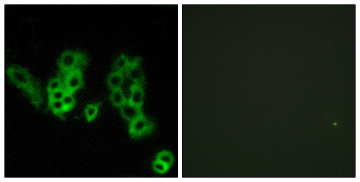 Encephalopsin / OPN3 Antibody - Immunofluorescence analysis of MCF7 cells, using Encephalopsin Antibody. The picture on the right is blocked with the synthesized peptide.