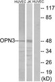 Encephalopsin / OPN3 Antibody - Western blot analysis of lysates from HUVEC and Jurkat cells, using OPN3 Antibody. The lane on the right is blocked with the synthesized peptide.