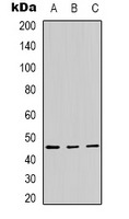 Encephalopsin / OPN3 Antibody - Western blot analysis of Panopsin expression in HeLa (A); A431 (B); mouse brain (C) whole cell lysates.